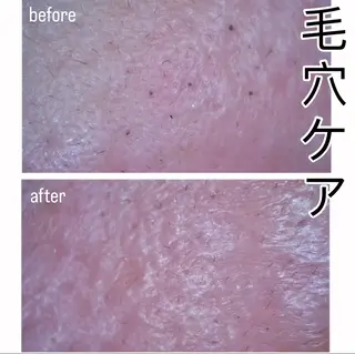 DISINI  SPA所属・DISINISPA 脱毛/フェイシャルのエステ・リラクイメージ