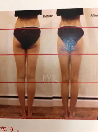 カラー マツエク・マツパ 美容鍼専門 ハリエンジュのエステ・リラクイメージ