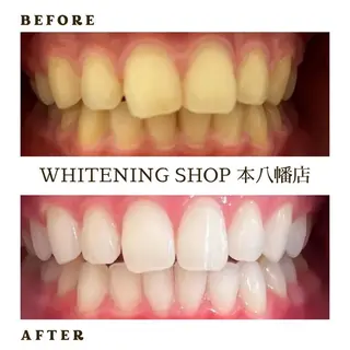 メンズ ホワイトニング ショップ本八幡店のエステ・リラクイメージ