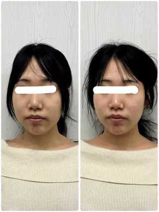 美容鍼×小顔矯正 ×美容整体　浜川泰仁のエステ・リラクイメージ