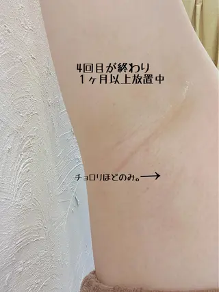 セルフ脱毛 atelier aoのエステ・リラクイメージ