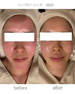 anthes /MIHOのエステ・リラクイメージ