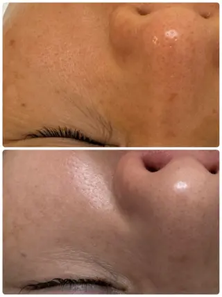 シミ毛穴専門店 yucca(ユッカ)のエステ・リラクイメージ