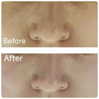 ICHOOSE/ 代々木上原のエステ・リラクイメージ