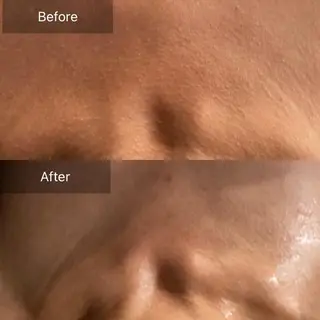毛穴から始める肌メン テマンダリンオレンジのエステ・リラクイメージ