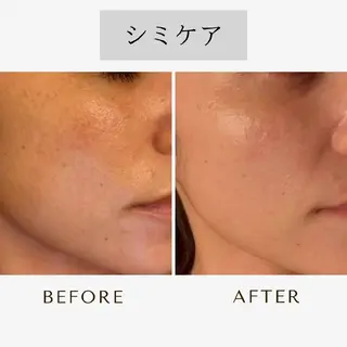 ICHOOSE/ 代々木上原のエステ・リラクイメージ