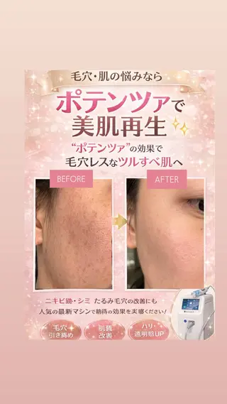 マツエク・マツパ 愛維美水光美肌専門店 メンズレディースokのエステ・リラクイメージ