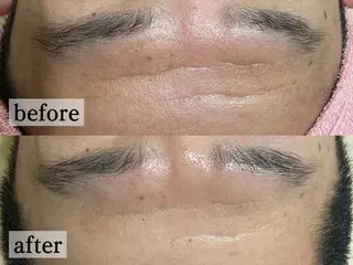 フェイシャル/脱毛 ジョアアンジェ竹田のエステ・リラクイメージ