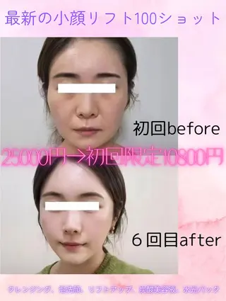 マツエク・マツパ 愛維美水光美肌専門店 メンズレディースokのエステ・リラクイメージ