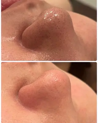メンズ 美 Faceのエステ・リラクイメージ