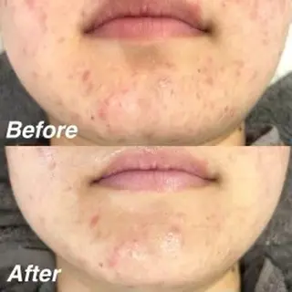 秒速小顔新宿南口 大谷のその他イメージ