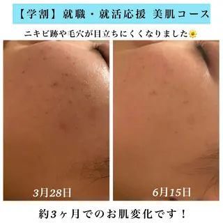 Bellesthe (ベルエステ)のエステ・リラクイメージ