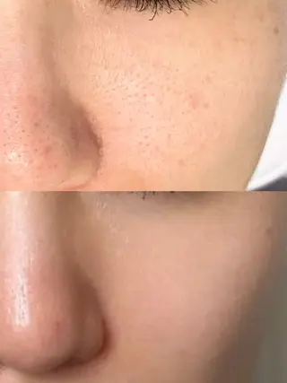 Dahlia痩身脱毛 フェイシャル 中村のエステ・リラクイメージ