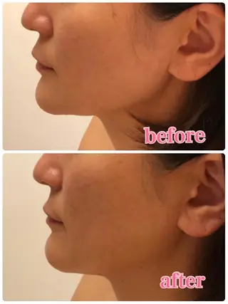 朝重い人専用 肩甲骨調整のエステ・リラクイメージ