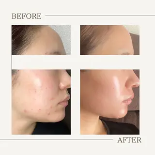 肌育成サロン ♡ RISAのエステ・リラクイメージ