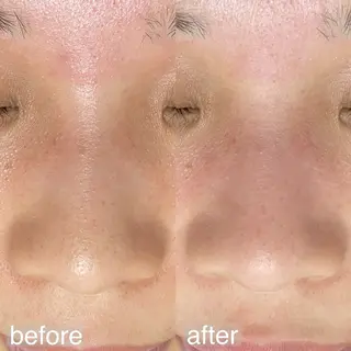 アイブロウ&フェイシャルサロンa‘lm所属・WAX脱毛/肌質改善 眉毛とお肌のサロンのエステ・リラクイメージ