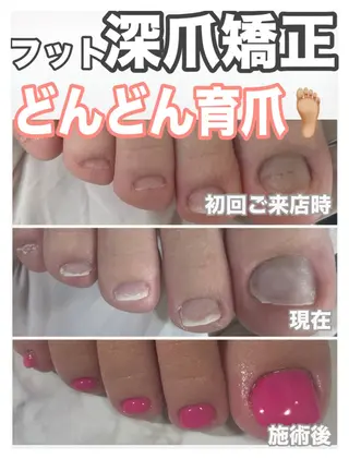 ネイル nail salon petillantのネイルデザイン