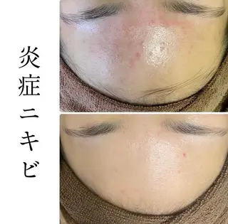 ハーブピーリング専門 BIOPLUS+川崎のエステ・リラクイメージ