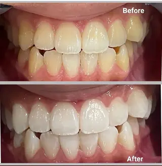 アイラッシュサロン ミノのマツエク・マツパデザイン