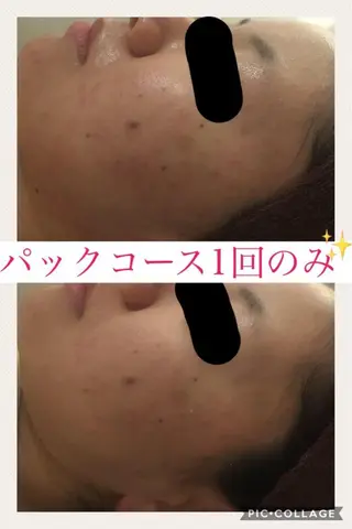 ミディアム カラー パーマ ヘアアレンジ メンズ キッズ ネイル マツエク・マツパ ニキビ・肌質改善専門 ♡人生が変わるサロンのエステ・リラクイメージ