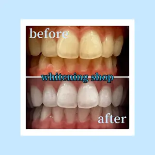 ホワイトニングショップ光明池店所属・ホワイトニング ショップ光明池店のエステ・リラクイメージ