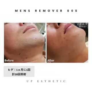 メンズ 韓国肌管理 ウプエステティックのエステ・リラクイメージ