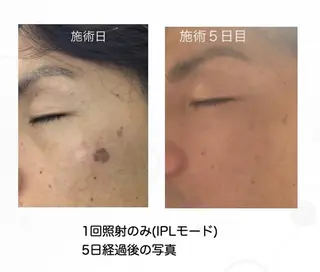 Felice🌸脱毛 ・光フェイシャルのエステ・リラクイメージ