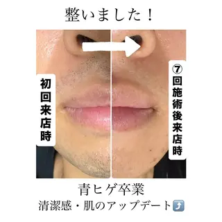 メンズ メンズ脱毛サロン Le falcoのエステ・リラクイメージ