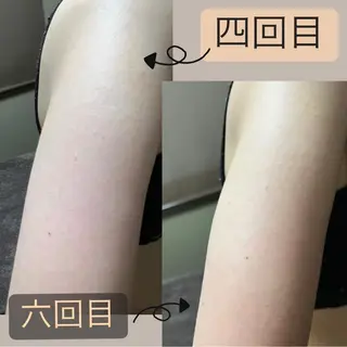 lymph care 'Welnəsのエステ・リラクイメージ