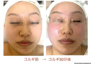 小顔コルギ10年 みなみ・池袋のエステ・リラクイメージ