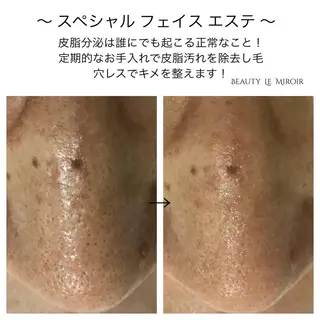 マツエク・マツパ ビューティー ミロワールのエステ・リラクイメージ