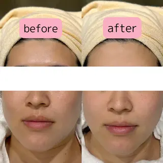 pansy フェイシャルエステのエステ・リラクイメージ