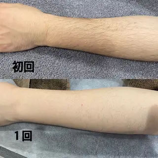 メンズ 泰中 郁未のエステ・リラクイメージ