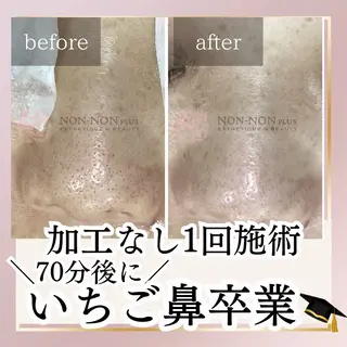 NON-NONプラス 大人の本気痩身のエステ・リラクイメージ