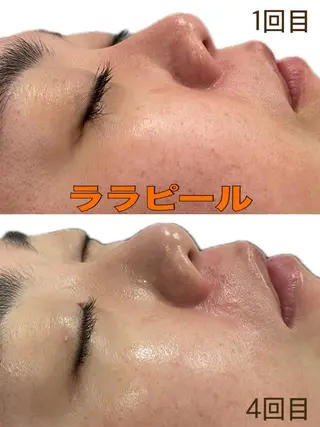 徳山 まみのエステ・リラクイメージ