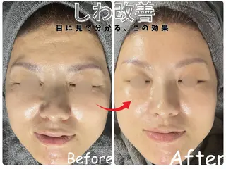 ele"ハーブ ピーリング 専門店のエステ・リラクイメージ