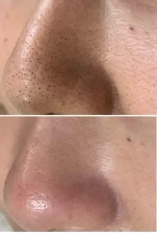 BELINDA HITOMIのマツエク・マツパデザイン