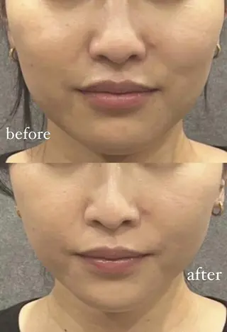 マツエク・マツパ MIU Rimの眉毛・アイブロウイメージ