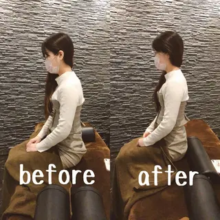 小顔矯/美容鍼/鍼灸 BeauJuのその他イメージ