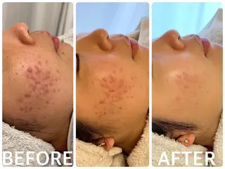 ハーブピーリング横浜 肌質改善専門店のその他イメージ