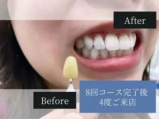 ホワイトニングカフェ 中野店のその他イメージ