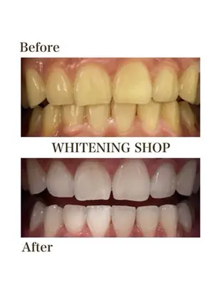 ホワイトニングショップ津店所属・ホワイトニング ショップ津店のその他イメージ