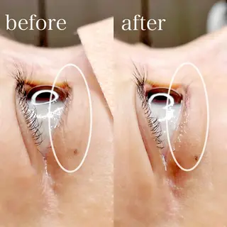 マツエク・マツパ 🤍二条城北iu. /IKUHOのマツエク・マツパデザイン