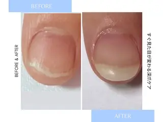 メンズ ネイル 爪ケア/深爪 自爪育成 🐰えむのネイルデザイン