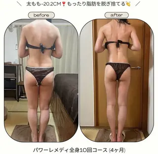 《本気痩せ×疲労改善 》  BILOOPのエステ・リラクイメージ