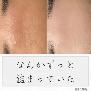 ニキビ経験者が施術 する専門サロン🌻のエステ・リラクイメージ