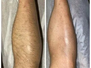 メンズ 都度払い脱毛サロン　RE:JU17所属・エドワーズ 亜理沙のエステ・リラクイメージ