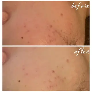 メンズ メナード岐阜市茜部 杉浦のエステ・リラクイメージ