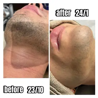 Body care salon LUANA所属・LUANA/小顔整体 men's脱毛のその他イメージ