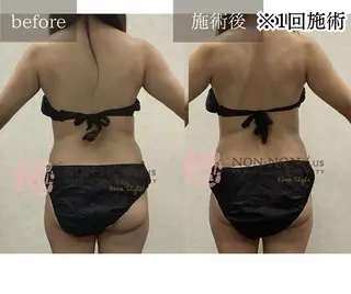 NON-NONプラス 大人の本気痩身のエステ・リラクイメージ